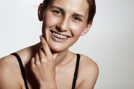 Technique Damon orthodontie